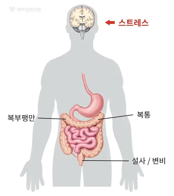 소아 청소년 치료 - 과민성대장 / 식욕부진
