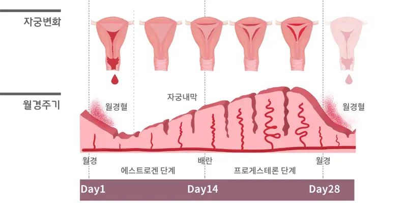 여성 부인과 치료 - (월경통, dysmenorrhea)