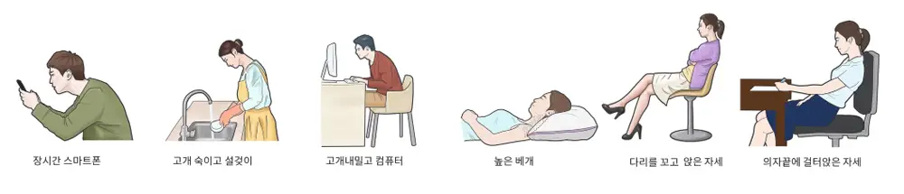 자세교정 원인 치료 - 근육 불균형
