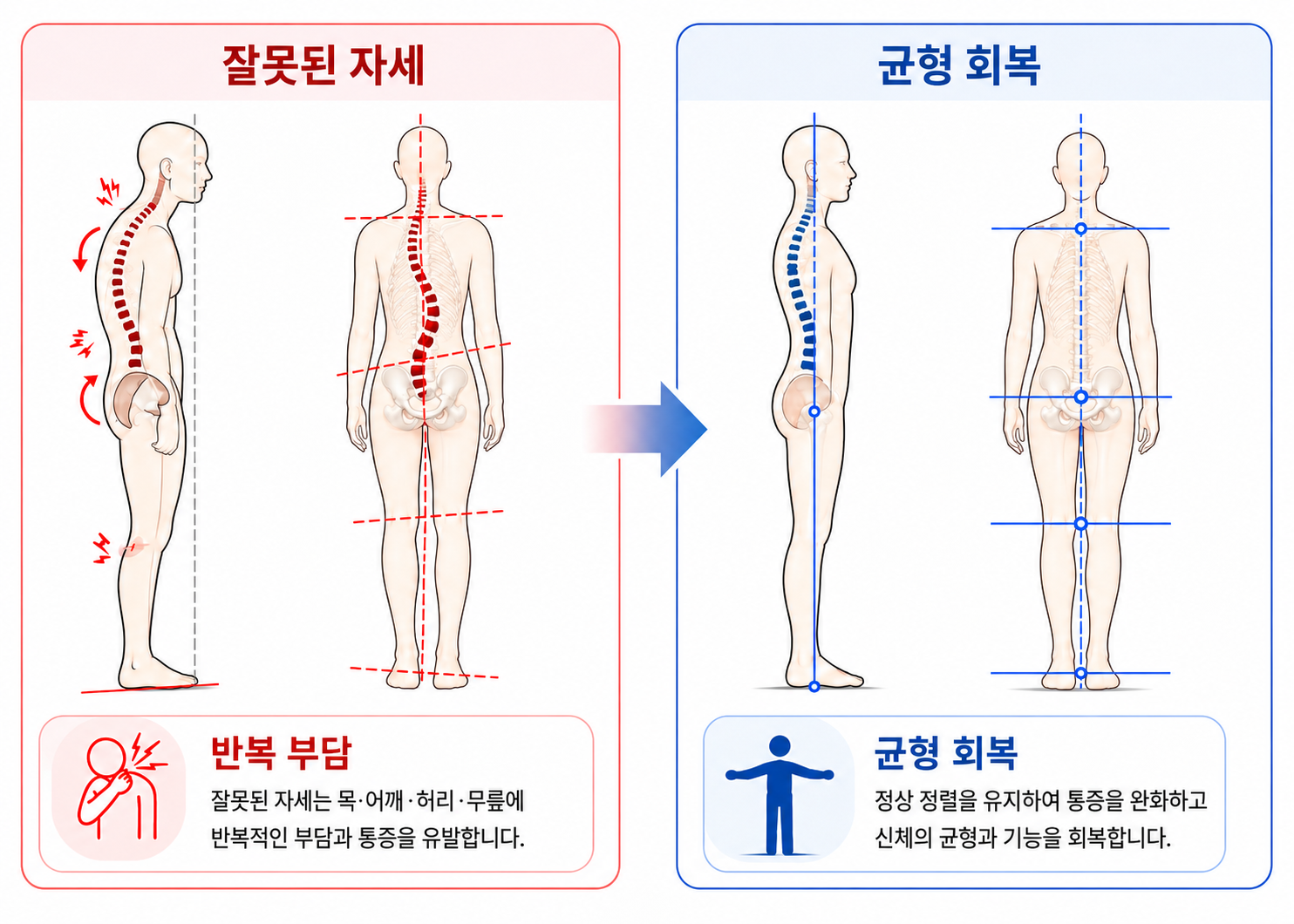만성통증 원인 치료 - 전신균형 자세교정